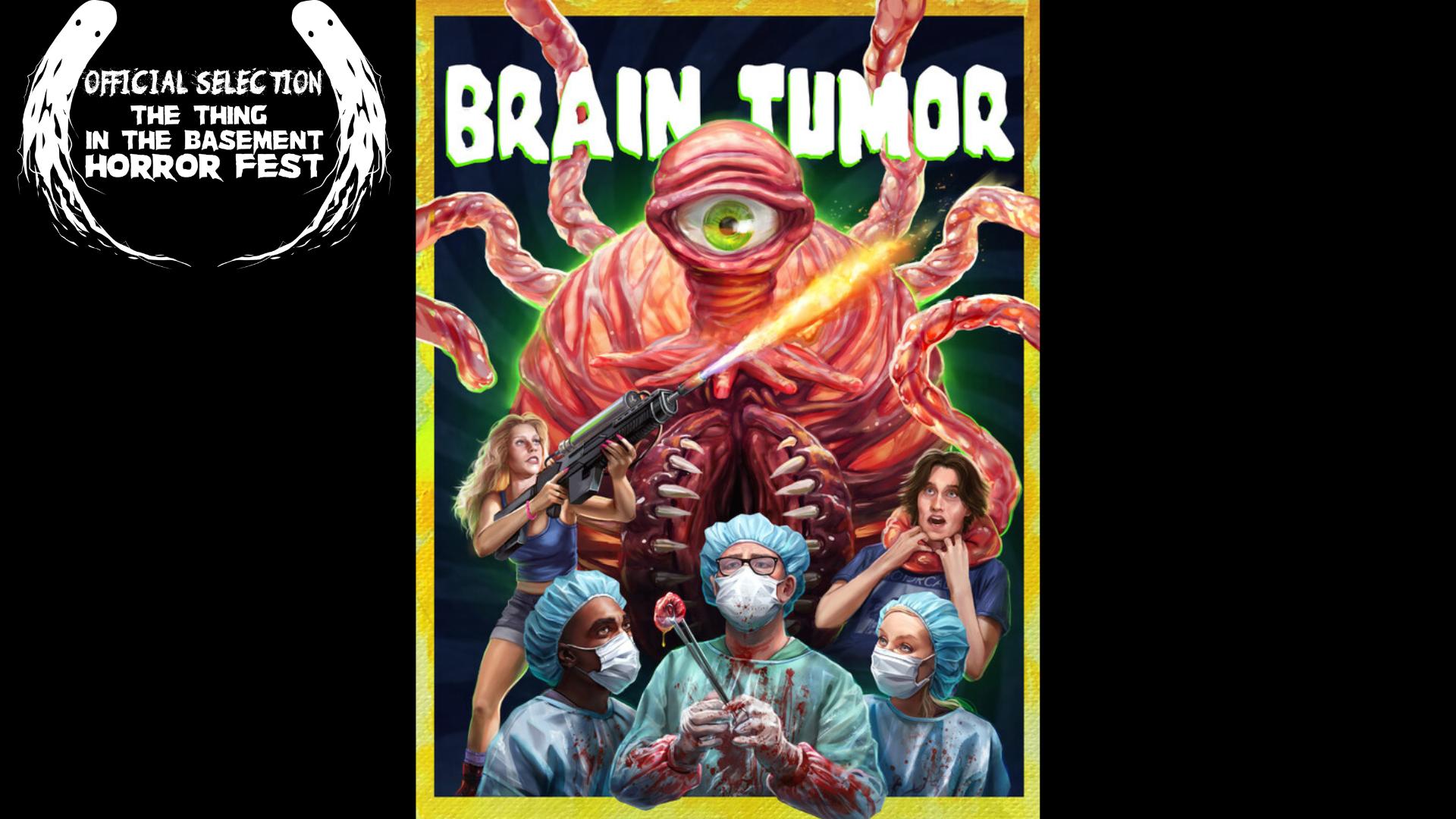 Brain Tumor